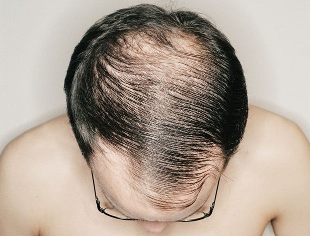 How To Grow Thicker Hair