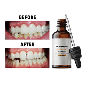 Groomarang Tooth And Gum Treatment Oil 30ml - Extra Fresh and Extra Strength | FREE Postage